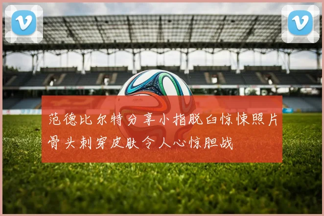 范德比尔特分享小指脱臼惊悚照片骨头刺穿皮肤令人心惊胆战